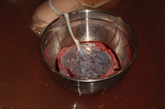 Placenta Encapsulation